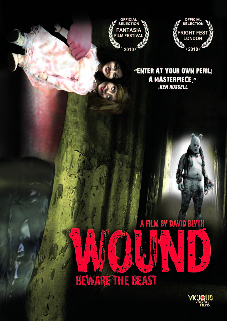 Wound